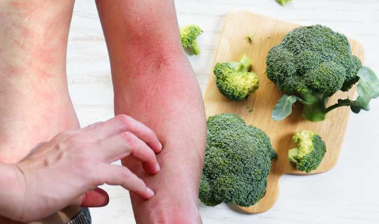Can You Be Allergic to Broccoli